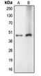 Ceramide Synthase 4 antibody, LS-C353550, Lifespan Biosciences, Western Blot image 