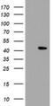 Lipid Droplet Associated Hydrolase antibody, NBP2-03718, Novus Biologicals, Western Blot image 
