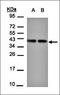 Tubulin Folding Cofactor C antibody, orb69789, Biorbyt, Western Blot image 