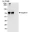 Septin-9 antibody, NBP1-28764, Novus Biologicals, Immunoprecipitation image 