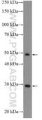 Inducible T Cell Costimulator antibody, 13338-1-AP, Proteintech Group, Western Blot image 