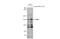 BLM RecQ Like Helicase antibody, GTX101303, GeneTex, Western Blot image 