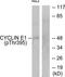 Cyclin E1 antibody, TA311852, Origene, Western Blot image 
