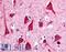 Melatonin Receptor 1B antibody, LS-A933, Lifespan Biosciences, Immunohistochemistry paraffin image 
