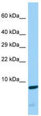 CDC42 Small Effector 2 antibody, TA331833, Origene, Western Blot image 