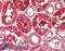 Platelet Derived Growth Factor Subunit B antibody, LS-B14260, Lifespan Biosciences, Immunohistochemistry paraffin image 