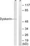 Dyskerin Pseudouridine Synthase 1 antibody, GTX87872, GeneTex, Western Blot image 