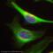 Protein Kinase D1 antibody, ab74115, Abcam, Immunofluorescence image 