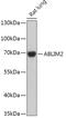 Actin Binding LIM Protein Family Member 2 antibody, 18-101, ProSci, Western Blot image 