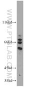 Centrosomal Protein 63 antibody, 16268-1-AP, Proteintech Group, Western Blot image 
