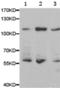 DNA Ligase 4 antibody, TA323263, Origene, Western Blot image 