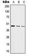 Jun Proto-Oncogene, AP-1 Transcription Factor Subunit antibody, LS-C352430, Lifespan Biosciences, Western Blot image 