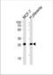 PRL-R antibody, TA328160, Origene, Western Blot image 