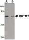 Leucine Rich Repeat Transmembrane Neuronal 2 antibody, PA5-21097, Invitrogen Antibodies, Western Blot image 