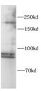 Dicer 1, Ribonuclease III antibody, FNab10456, FineTest, Western Blot image 