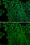 RNA Polymerase I And III Subunit C antibody, GTX64968, GeneTex, Immunocytochemistry image 