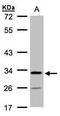 Chromosome 4 Open Reading Frame 19 antibody, PA5-34718, Invitrogen Antibodies, Western Blot image 