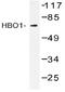 Histone acetyltransferase MYST2 antibody, AP20402PU-N, Origene, Western Blot image 