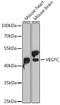 Vascular Endothelial Growth Factor C antibody, GTX32962, GeneTex, Western Blot image 