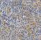 Protein Kinase C Epsilon antibody, FNab06484, FineTest, Immunohistochemistry paraffin image 