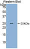 Pyruvate Kinase L/R antibody, LS-C296170, Lifespan Biosciences, Western Blot image 