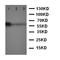 Methyl-CpG-binding domain protein 4 antibody, orb99204, Biorbyt, Western Blot image 