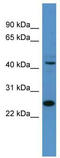 TFDP1 antibody, TA343658, Origene, Western Blot image 
