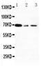 X-Ray Repair Cross Complementing 1 antibody, PA5-80238, Invitrogen Antibodies, Western Blot image 
