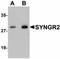 Synaptogyrin 2 antibody, orb94359, Biorbyt, Western Blot image 