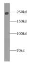 Claspin antibody, FNab01775, FineTest, Western Blot image 