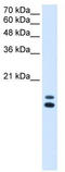 Ubiquitously Expressed Prefoldin Like Chaperone antibody, TA339896, Origene, Western Blot image 