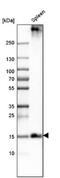 Placenta Associated 8 antibody, NBP1-90721, Novus Biologicals, Western Blot image 