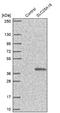 Graves disease carrier protein antibody, NBP1-91933, Novus Biologicals, Western Blot image 