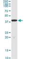 DnaJ Heat Shock Protein Family (Hsp40) Member B4 antibody, H00011080-M02, Novus Biologicals, Immunoprecipitation image 