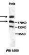 ALMS1 Centrosome And Basal Body Associated Protein antibody, orb77038, Biorbyt, Western Blot image 