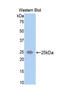 Spectrin alpha chain, brain antibody, LS-C303458, Lifespan Biosciences, Western Blot image 