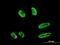 Ring Finger Protein 151 antibody, MA5-24525, Invitrogen Antibodies, Immunofluorescence image 