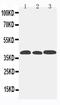 C-C Motif Chemokine Receptor 5 (Gene/Pseudogene) antibody, PA5-78950, Invitrogen Antibodies, Western Blot image 