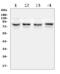 Transient Receptor Potential Cation Channel Subfamily V Member 5 antibody, A03218-1, Boster Biological Technology, Western Blot image 