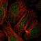 Zinc Finger BED-Type Containing 5 antibody, PA5-61747, Invitrogen Antibodies, Immunofluorescence image 