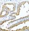 Cytoplasmic protein NCK2 antibody, FNab05584, FineTest, Immunohistochemistry paraffin image 