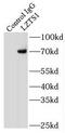 Leucine Zipper Tumor Suppressor 1 antibody, FNab04917, FineTest, Immunoprecipitation image 