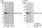 Calcium/Calmodulin Dependent Protein Kinase ID antibody, A302-667A, Bethyl Labs, Western Blot image 