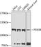 Phosphodiesterase 3B antibody, GTX64454, GeneTex, Western Blot image 