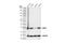 NAD(P)H Quinone Dehydrogenase 1 antibody, 62262S, Cell Signaling Technology, Western Blot image 