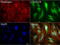 Cancer/Testis Antigen 1B antibody, LS-C796740, Lifespan Biosciences, Immunofluorescence image 