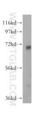 Glutathione S-transferase C-terminal domain-containing protein antibody, 17502-1-AP, Proteintech Group, Western Blot image 