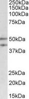 Meis Homeobox 2 antibody, TA311585, Origene, Western Blot image 
