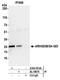Rho GDP Dissociation Inhibitor Beta antibody, A304-815A, Bethyl Labs, Immunoprecipitation image 