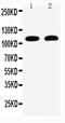 Desmoglein 3 antibody, GTX11943, GeneTex, Western Blot image 